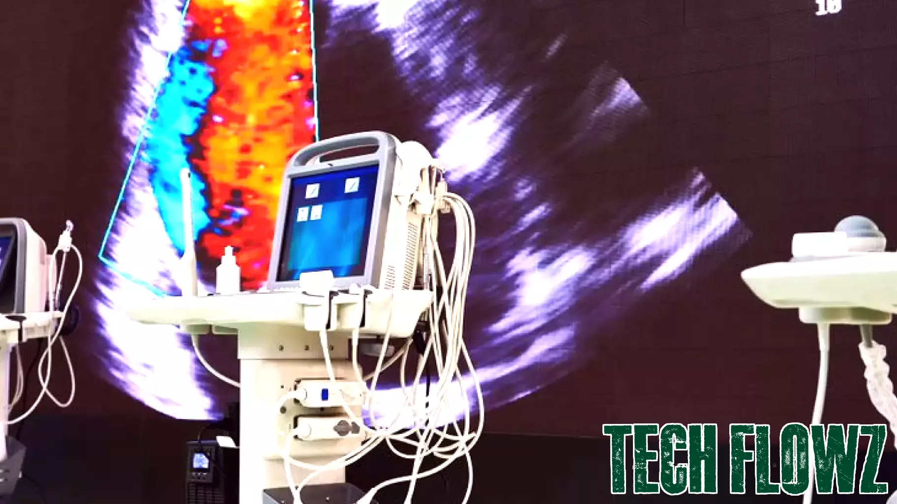 Tactile Systems Technology: Analyzing the Stability in Market Valuation